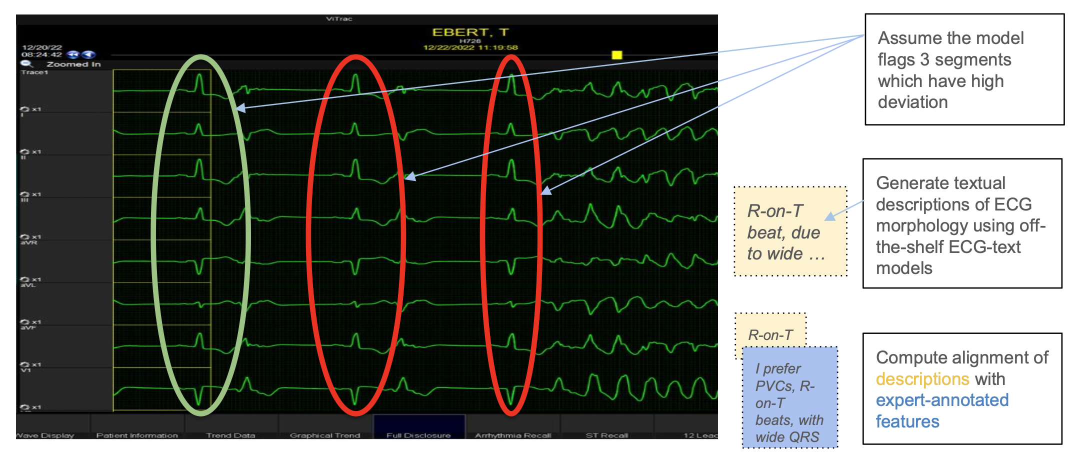 Neurosymbolic ECG